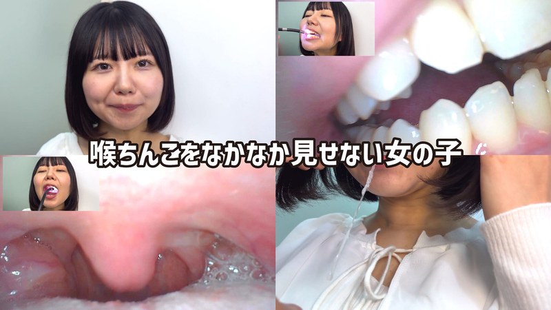 街角で声をかけて口内観察させてもらう テレビ局AD みゆりちゃん